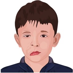 Illustration of Bell's Palsy